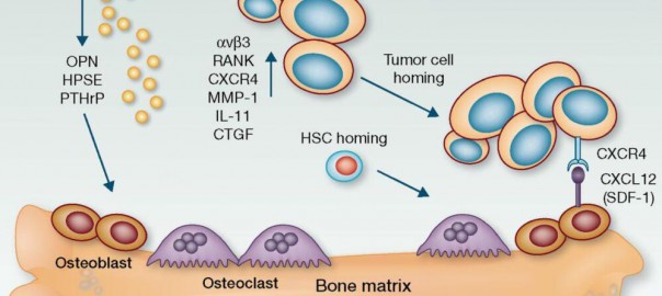 new antibody to fight bone metastatis