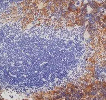 Anti-idiotypic Antibody