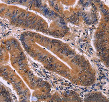 CDC Enhanced Antibody