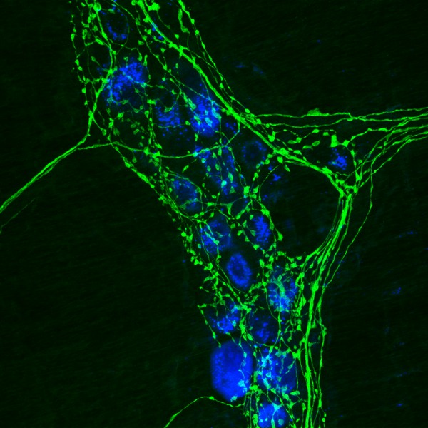 Fig. 1 Immunocytochemistry detects and identifies specific proteins present within cells.