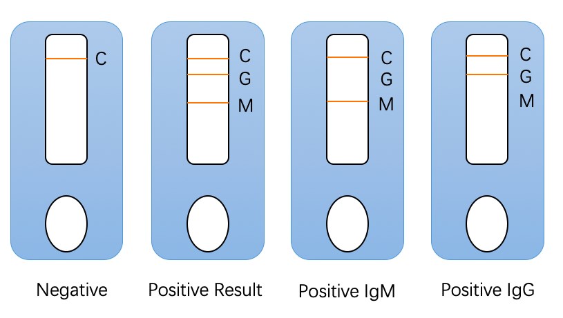 The results of IgG/IgM combined antibody detection kit.