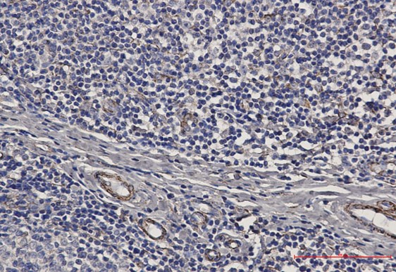 IHC Kit and Antibody Products