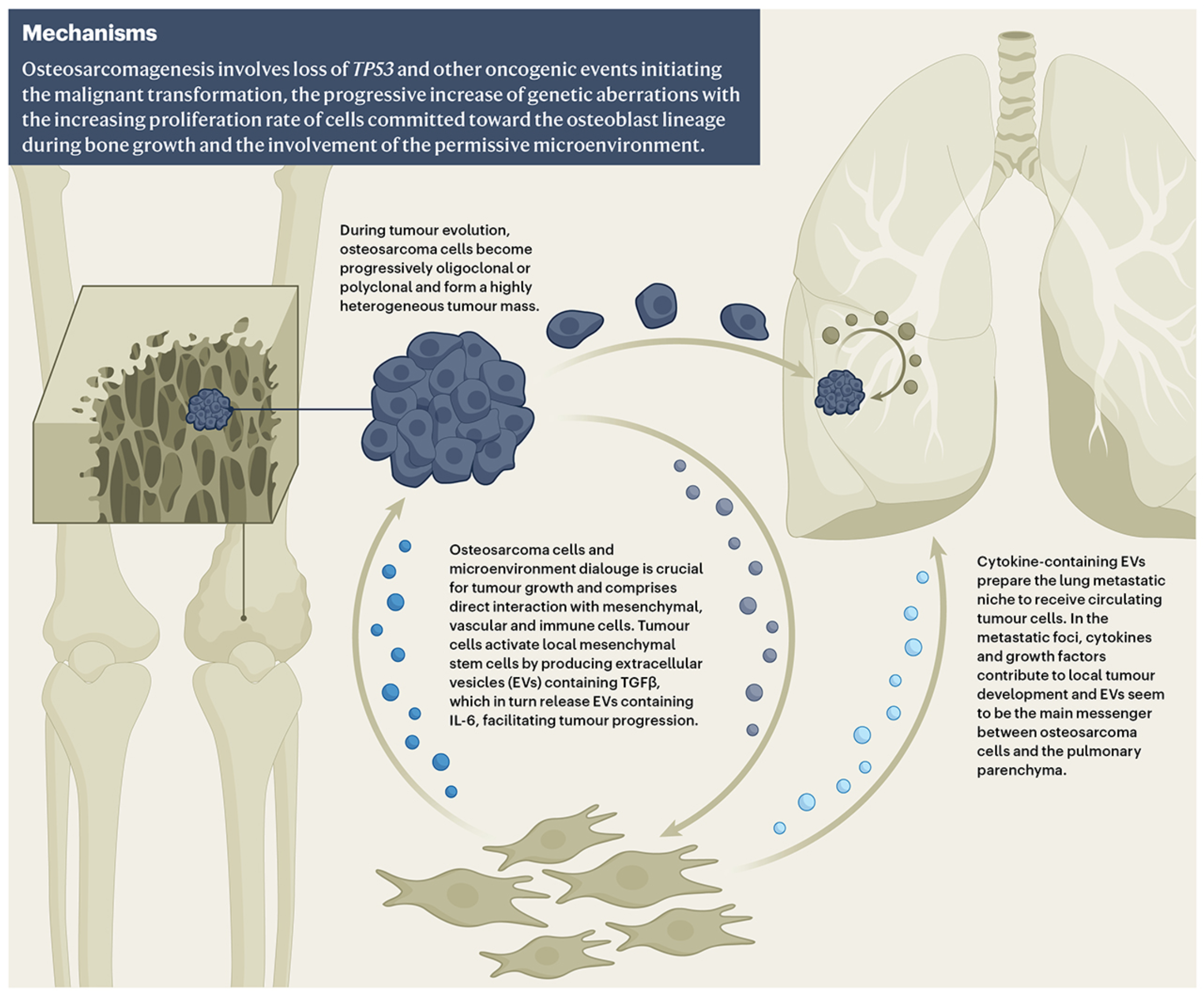 Figure 1 Mechanisms of osteosarcoma. (Beird, 2022)