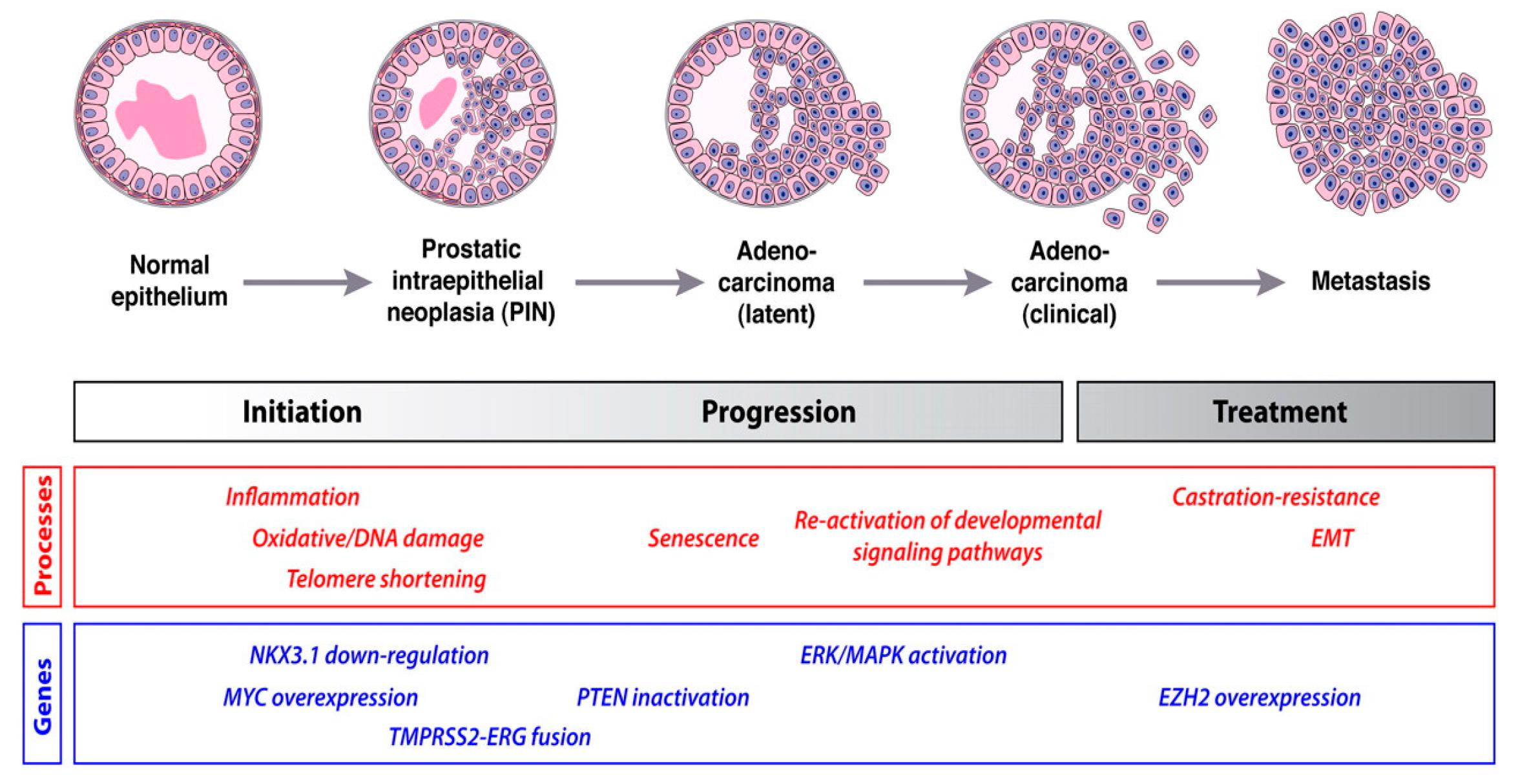 Figure 1 A schematic depicting the development of prostate cancer. (Sekhoacha, 2022)