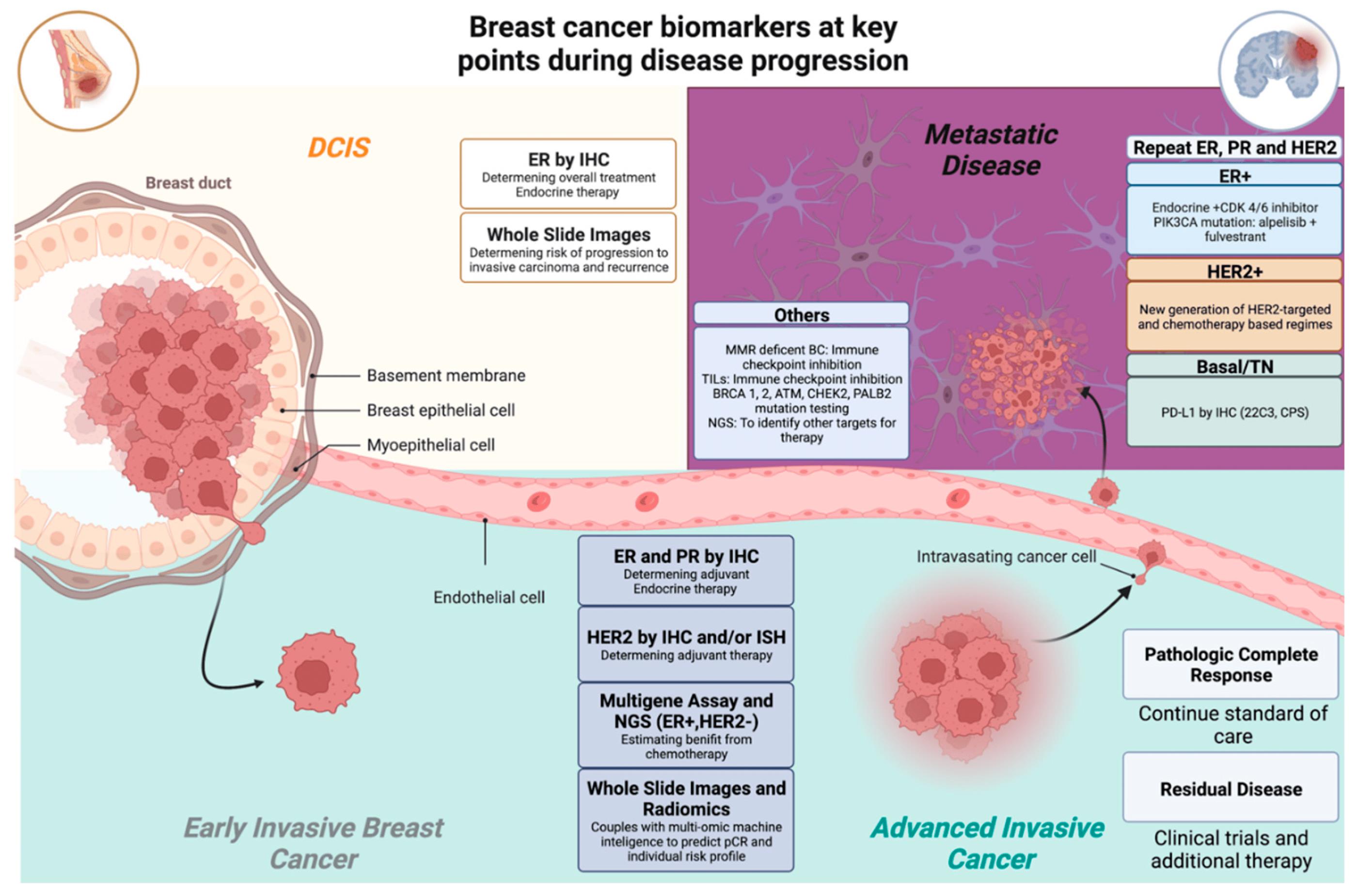Breast cancer biomarkers at key points during disease progression