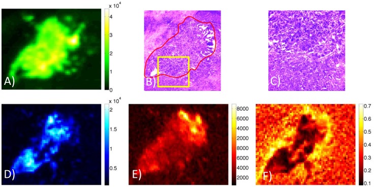 Antibody distribution within the tumor area. (OA Literature)
