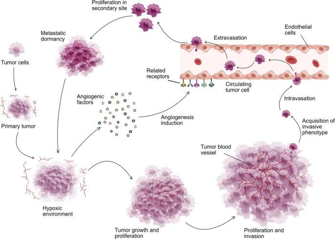 Carcinogenic progression through angiogenesis. (OA Literature)