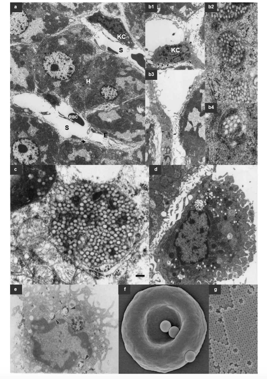 Liver Sinusoids, Kupffer Cells And Nanoparticles. 