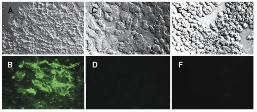 Binding of Anti-ED-B scFv-liposomes to Cells Cultured for 48 h on Collagen-I Coated Cover Slips.