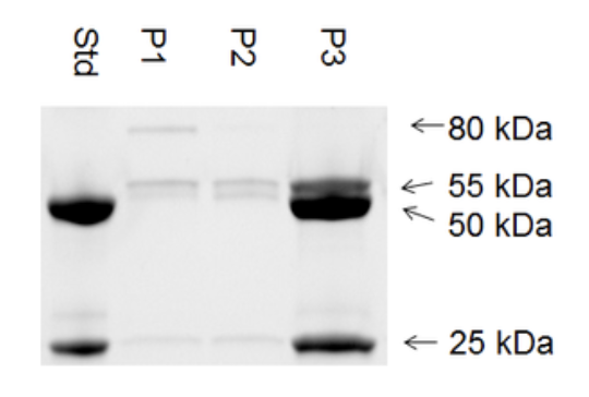 Purity analysis by SDS-PAGE