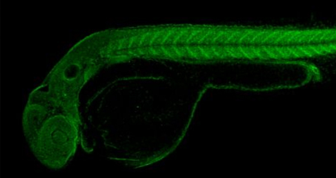 Anti-idiotypic Antibody