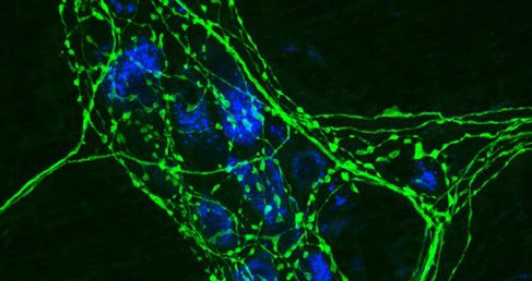 Antibody Labeling Kits