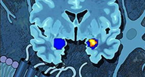 Neuroscience Antibody