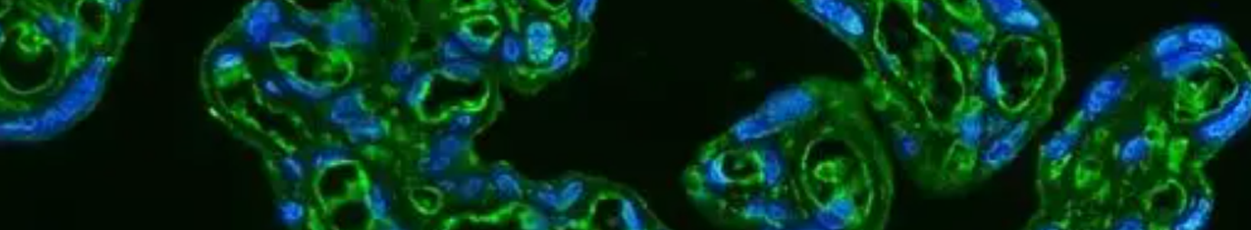 Antibody-like scaffold protein