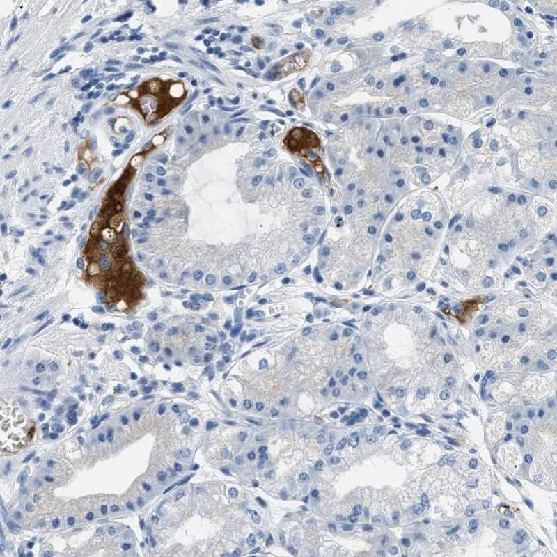 IHC stomach analysis. (Creative Biolabs Original)