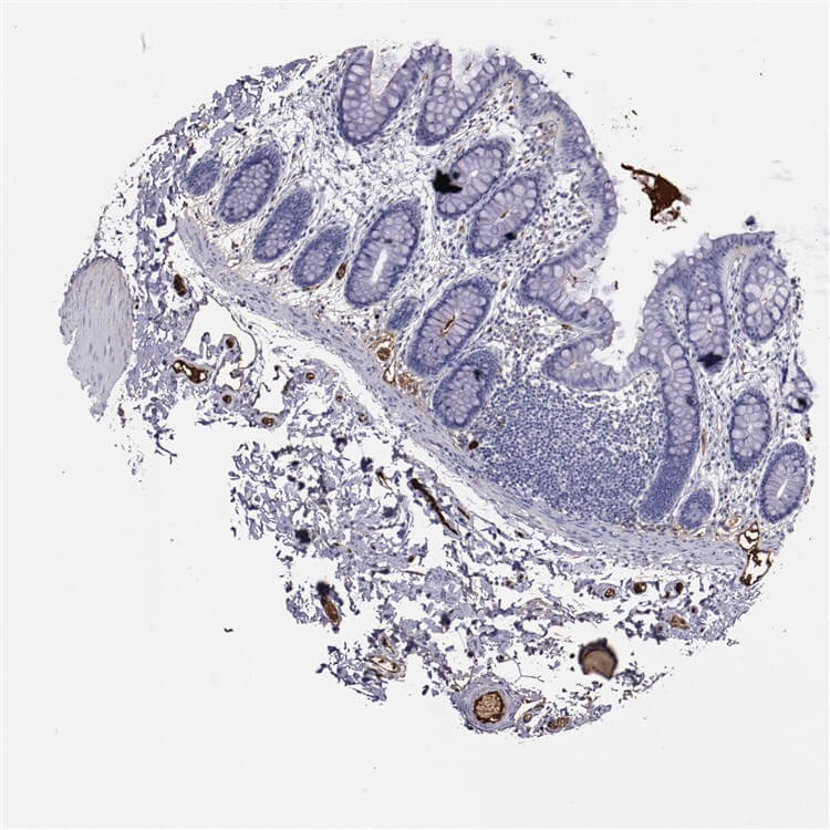 IHC colon analysis. (Creative Biolabs Original)