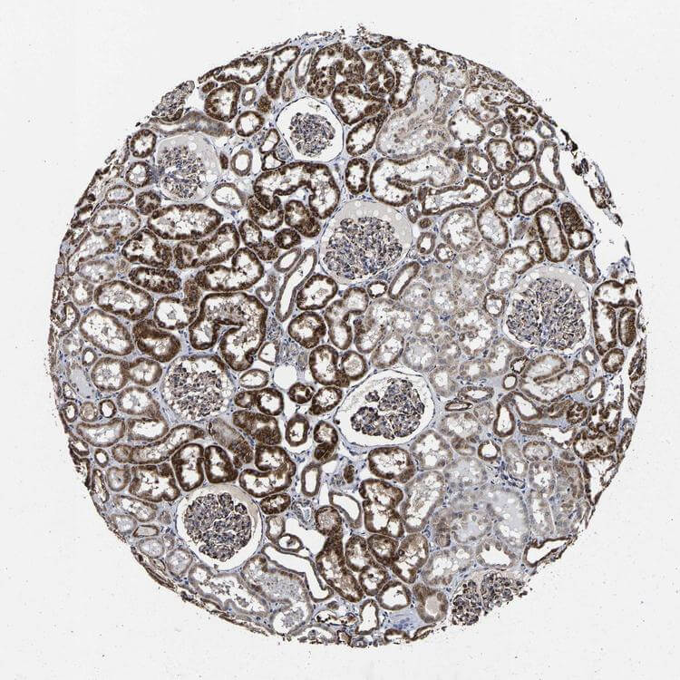 IHC analysis. (Creative Biolabs Original)
