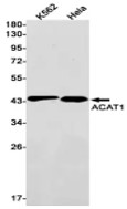 Fig.1 WB analysis of VS3-FY13. (Creative Biolabs Original)