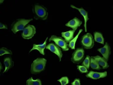 IF analysis. (Creative Biolabs Original)