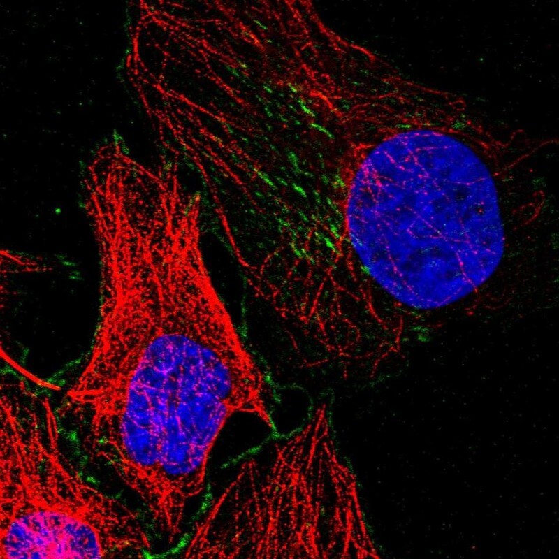 IF analysis. (Creative Biolabs Original)