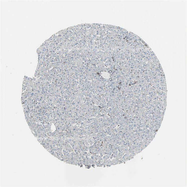 Liver IHC analysis. (Creative Biolabs Original)