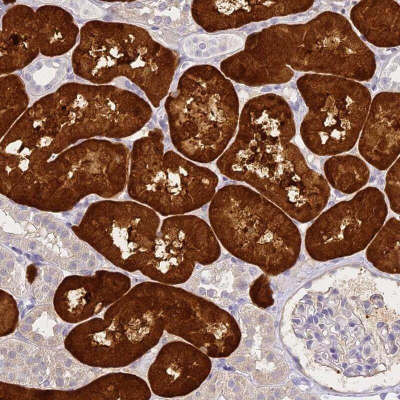 IHC analysis. (Creative Biolabs Original)