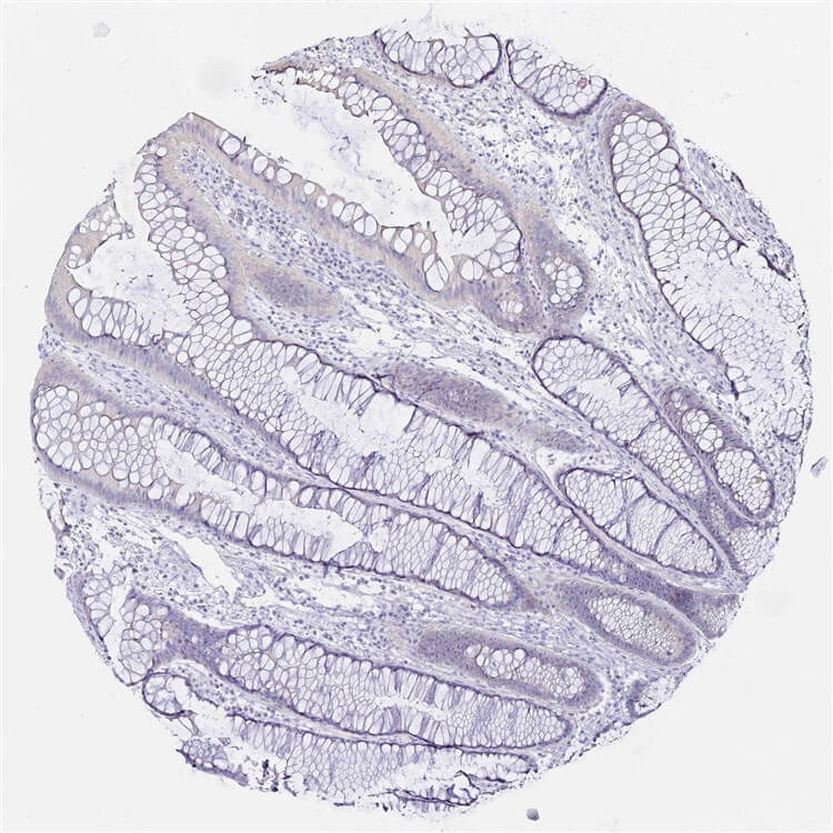 Colon IHC analysis. (Creative Biolabs Original)