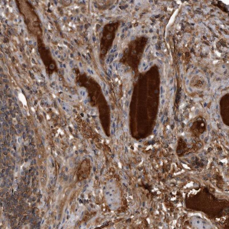 IHC analysis. (Creative Biolabs Original)