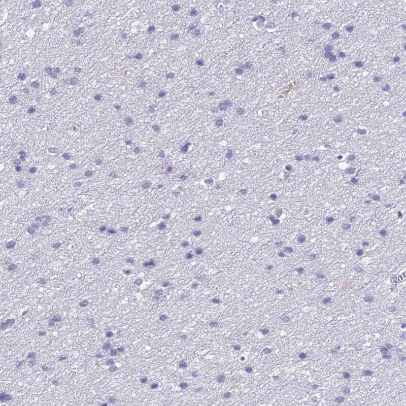 IHC staining. (Creative Biolabs Original)
