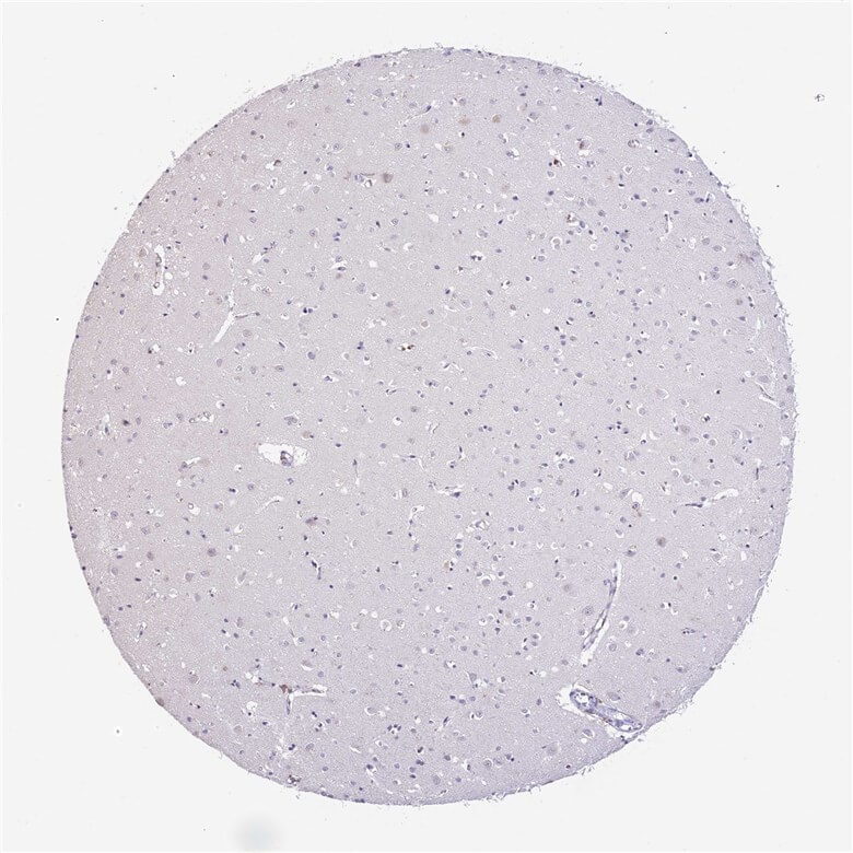 Cerebral cortex IHC analysis. (Creative Biolabs Original)
