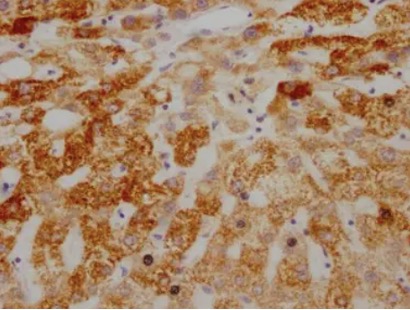 IHC analysis. (Creative Biolabs Original)