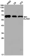 Fig.1 WB analysis of VS3-FY59. (Creative Biolabs Original)