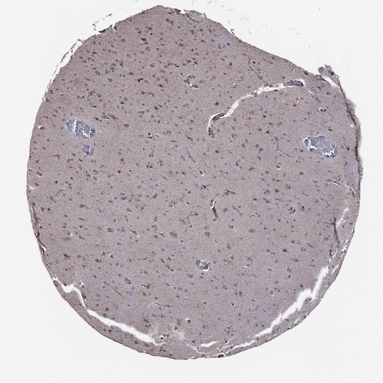 IHC staining. (Creative Biolabs Original)