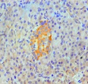IHC analysis. (Creative Biolabs Original)