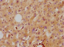 IHC analysis. (Creative Biolabs Original)