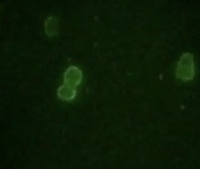 IF analysis. (Creative Biolabs Original)