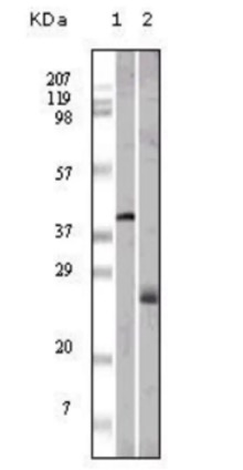 WB analysis. (Creative Biolabs Original)