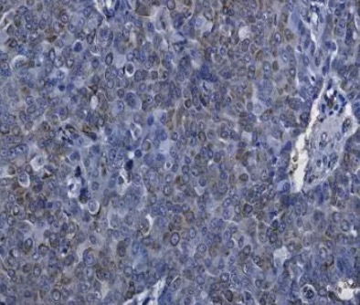 IHC analysis. (Creative Biolabs Original)