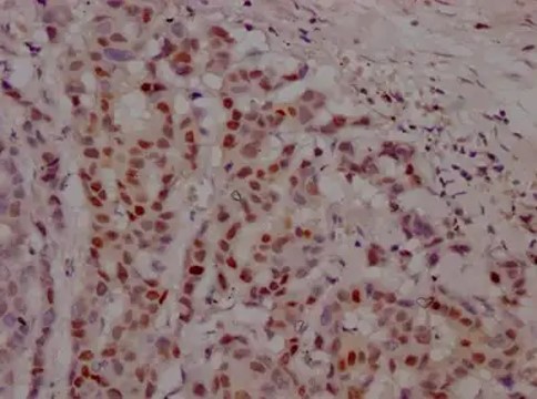 Fig.2 IHC analysis of anti-AR recombinant antibody (ZG-0548J). (Creative Biolabs Original)
