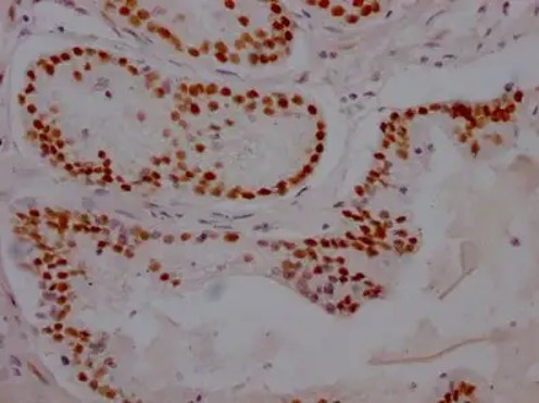 Fig.3 IHC analysis of anti-AR recombinant antibody (ZG-0548J). (Creative Biolabs Original)