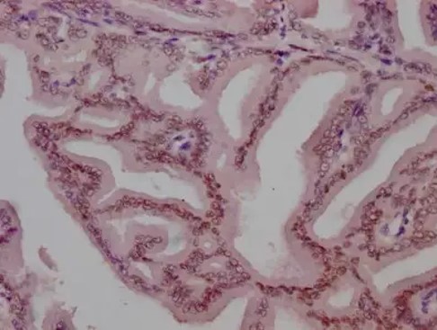 Fig.4 IHC analysis of anti-AR recombinant antibody (ZG-0549J). (Creative Biolabs Original)
