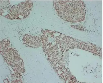 Fig.5 IHC analysis of anti-AR recombinant antibody (ZG-0031J). (Creative Biolabs Original)