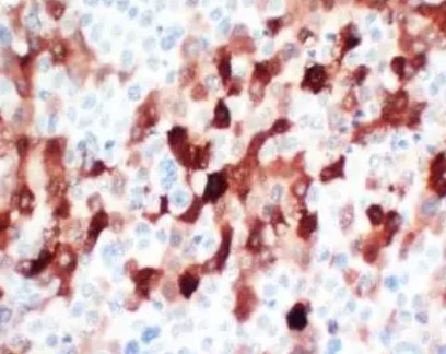 IHC analysis. (Creative Biolabs Original)