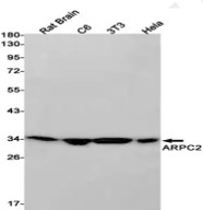 Fig.1 WB analysis of VS3-FY98. (Creative Biolabs Original)
