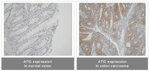 IHC analysis. (Creative Biolabs Original)