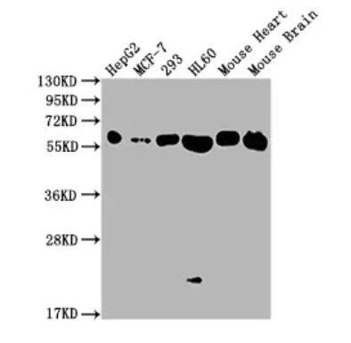 WB analysis. (Creative Biolabs Original)