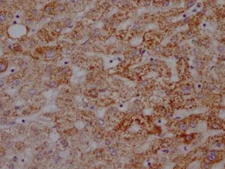 IHC analysis. (Creative Biolabs Original)