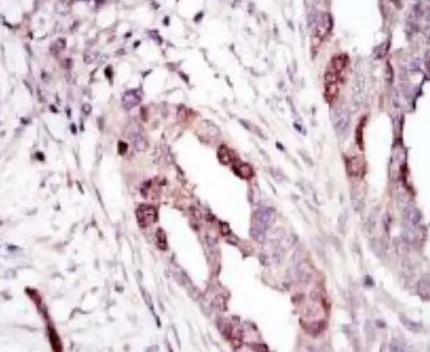 IHC analysis. (Creative Biolabs Original)