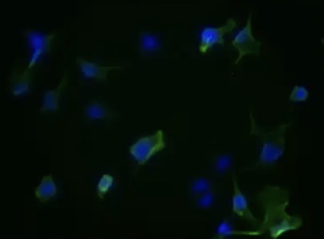 IF analysis. (Creative Biolabs Original)