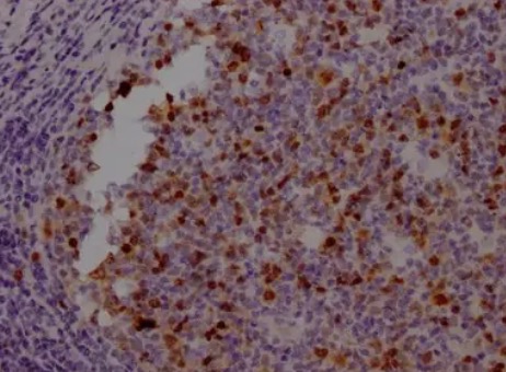 IHC analysis. (Creative Biolabs Original)